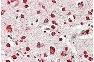 Image no. 1 for anti-Scavenger Receptor Class B, Member 2 (SCARB2) (Internal Region) antibody (ABIN375158) (SCARB2 抗体  (Internal Region))