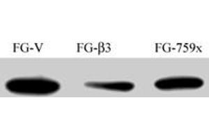 FG Pancreatic Carcinoma Cell Lines stably expressing vector along (FG-V) the beta3 integrin subunit (FG-beta3) or a beta3 truncation mutant (FG-759x) . (Src 抗体)
