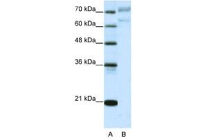 WB Suggested Anti-AATF Antibody Titration:  5. (AATF 抗体  (N-Term))