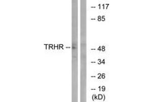Western blot analysis of extracts from COS7 cells, using TRHR Antibody. (TRHR 抗体  (AA 195-244))