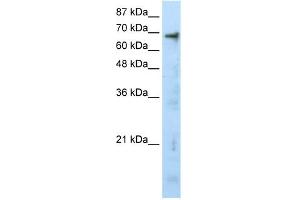 WB Suggested Anti-HTATIP Antibody Titration:  0. (KAT5 抗体  (N-Term))