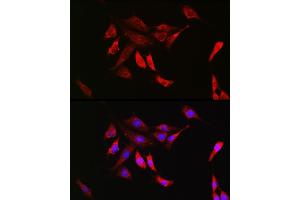 Immunofluorescence (IF) image for anti-Protein tyrosine Phosphatase, Non-Receptor Type 11 (PTPN11) antibody (ABIN7269704)