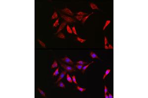 Immunofluorescence analysis of NIH/3T3 cells using SHP2 Rabbit mAb (ABIN7269704) at dilution of 1:100 (40x lens). (PTPN11 抗体)