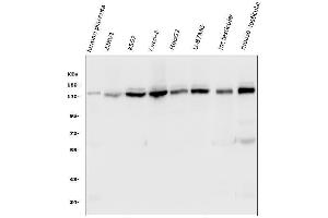 Western blot analysis of HAUSP/USP7 using anti-HAUSP/USP7 antibody (ABIN6719603).