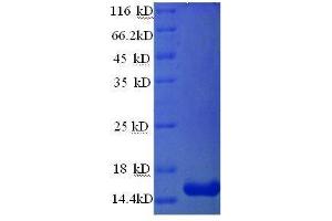 Prolactin-Induced Protein (PIP) (AA 27-146), (full length) protein (His tag) (PIP Protein (AA 27-146, full length) (His tag))
