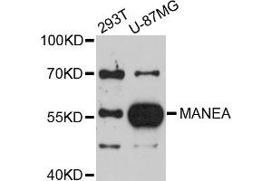 Western blot analysis of extracts of various cell lines, using MANEA antibody (ABIN5998166) at 1/1000 dilution. (MANEA 抗体)