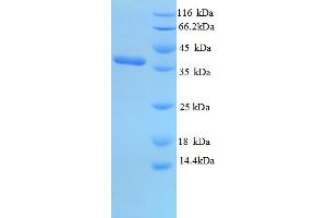 SDS-PAGE (SDS) image for Olfactory Marker Protein (OMP) (AA 27-349), (partial) protein (His tag) (ABIN5713022)