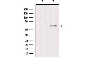 Western blot analysis of extracts from Hepg2, using MMP11 Antibody. (MMP11 抗体  (N-Term))