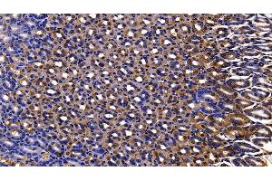 Immunohistochemistry (IHC) image for anti-Peroxiredoxin 2 (PRDX2) (AA 6-164) antibody (ABIN7437812)