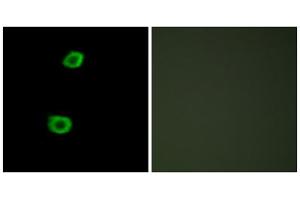 Immunofluorescence analysis of HepG2 cells, using LMTK2 antibody. (LMTK2 抗体  (Internal Region))