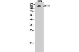 Western Blotting (WB) image for anti-Abelson Murine Leukemia Viral Oncogene Homolog 1/2 (ABL1/ABL2) (Lys5) antibody (ABIN3183134) (ABL1/2 抗体  (Lys5))