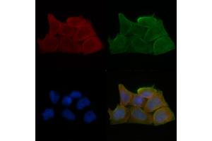 ABIN6259712 and ABIN6279061 staining Hela cells(30 min of UV treatment) by IF/ICC. (ACAD11 抗体  (Internal Region))