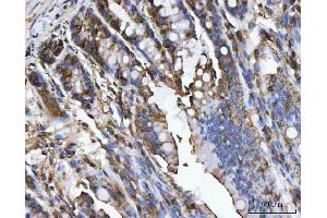 IHC analysis of CA1 using anti-CA1 antibody (ABIN3043766).