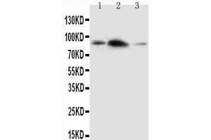 Anti-APLP2 antibody,  Western blotting Lane 1: Rat Brain Tissue Lysate Lane 2: Rat Heart Tissue Lysate Lane 3: SMMC Cell Lysate (APLP2 抗体  (C-Term))