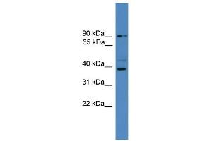 WB Suggested Anti-ZRANB1 Antibody Titration: 0. (ZRANB1 抗体  (C-Term))