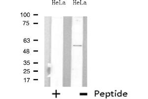 Western blot analysis of extracts from HeLa cells, using ARFGAP3 antibody. (ARFGAP3 抗体  (C-Term))