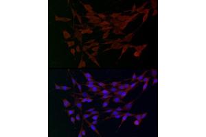 Immunofluorescence analysis of PC-12 cells using  Rabbit pAb (ABIN3016805, ABIN3016806, ABIN3016807 and ABIN6219845) at dilution of 1:100.