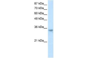 RNASEH2A antibody used at 1. (RNASEH2A 抗体  (Middle Region))