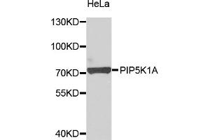 Western blot analysis of extracts of HeLa cells, using PIP5K1A antibody (ABIN5975757) at 1/1000 dilution. (PIP5K1A 抗体)