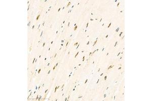 Immunohistochemistry analysis of paraffin embedded mouse heart using KCNIP3 (ABIN7073771) at dilution of 1: 2000 (DREAM 抗体)