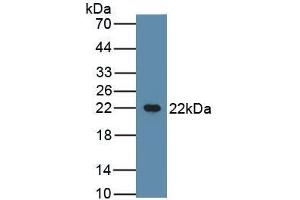Detection of Recombinant CSN2, Bovine using Polyclonal Antibody to Casein Beta (CSN2) (CSN2 抗体  (AA 16-224))