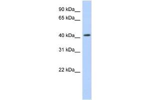 WB Suggested Anti-NR1H2 Antibody Titration:  0. (NR1H2 抗体  (Middle Region))