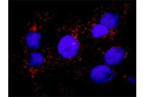 Proximity Ligation Analysis of protein-protein interactions between HSPB1 and F13A1.