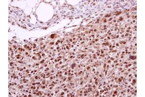 Immunohistochemistry (IHC) image for anti-Excision Repair Cross-Complementing Rodent Repair Deficiency, Complementation Group 2 (ERCC2) (Internal Region) antibody (ABIN2856090)