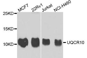 Western blot analysis of extracts of various cell lines, using UQCR10 antibody. (UQCR10 抗体)