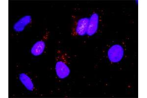 Proximity Ligation Analysis of protein-protein interactions between STAT5A and GHR. (Growth Hormone Receptor 抗体  (AA 19-118))
