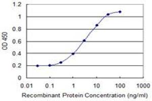 Detection limit for recombinant GST tagged MAP1S is 0. (MAP1S 抗体  (AA 929-1026))