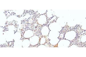 Immunohistochemistry (IHC) image for anti-Kruppel-Like Factor 1 (erythroid) (KLF1) (N-Term) antibody (ABIN184728)