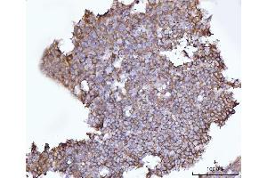 IHC analysis of SNAP23 using anti-SNAP23 antibody (ABIN7599089).