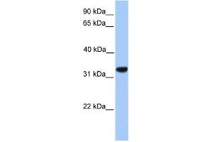 CACNG4 antibody used at 1 ug/ml to detect target protein. (CACNG4 抗体  (N-Term))