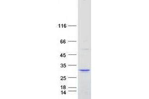 Validation with Western Blot (TP73-AS1K/IAA0495 Protein (Myc-DYKDDDDK Tag))