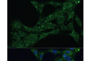 Immunofluorescence analysis of C6 cells using ETFB Polyclonal Antibody at dilution of 1:100 (40x lens). (ETFB 抗体)