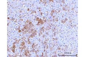 IHC analysis of RPS25 using anti-RPS25 antibody (ABIN7601567).