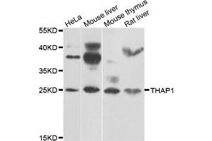 Western blot analysis of extracts of various cell lines, using THAP1 antibody (ABIN5975558) at 1/1000 dilution. (THAP1 抗体)