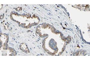 ABIN6268850 at 1/100 staining Human prostate tissue by IHC-P. (DCT 抗体  (N-Term))