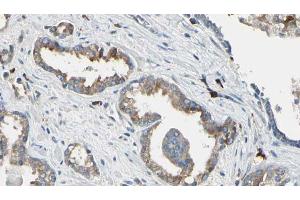 ABIN6268850 at 1/100 staining Human prostate tissue by IHC-P. (DCT 抗体  (N-Term))