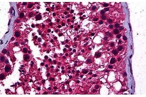 Human Testis: Formalin-Fixed, Paraffin-Embedded (FFPE) (STAT4 抗体  (AA 1-749))