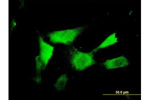 Immunofluorescence of monoclonal antibody to NAAA on NIH/3T3 cell. (NAAA 抗体  (AA 36-104))