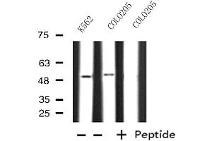 Western blot analysis of extracts from K562/COLO205 cells, using OAT antibody. (OAT 抗体  (Internal Region))