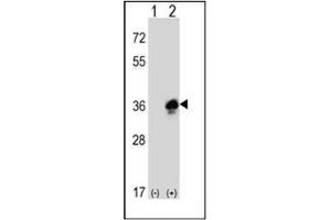 Western blot analysis of MPZ Antibody (C-term) .