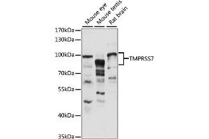 Western blot analysis of extracts of various cell lines, using TMPRSS7 antibody (ABIN7270949) at 1:1000 dilution. (TMPRSS7 抗体  (AA 478-717))