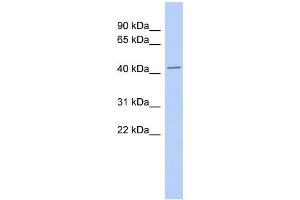 WB Suggested Anti-TMPO Antibody Titration:  0. (Thymopoietin 抗体  (Middle Region))