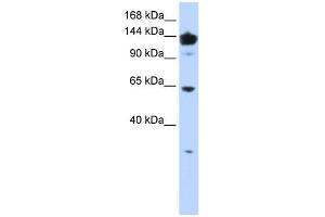 WB Suggested Anti-VARS Antibody Titration:  0. (VARS 抗体  (Middle Region))