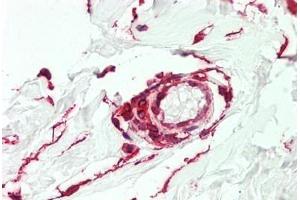 Human Vessel: Formalin-Fixed, Paraffin-Embedded (FFPE) (CTHRC1 抗体  (AA 32-142))