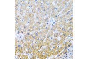 Immunohistochemistry of paraffin-embedded human liver using IL20 antibody (ABIN6128133, ABIN6142353, ABIN6142354 and ABIN6222322) at dilution of 1:100 (40x lens). (IL-20 抗体  (AA 25-176))
