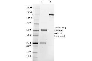 SDS-PAGE Analysis Purified FOLH1 (PSMA) Mouse Monoclonal Antibody (SPM500). (PSMA 抗体  (AA 232-433))
